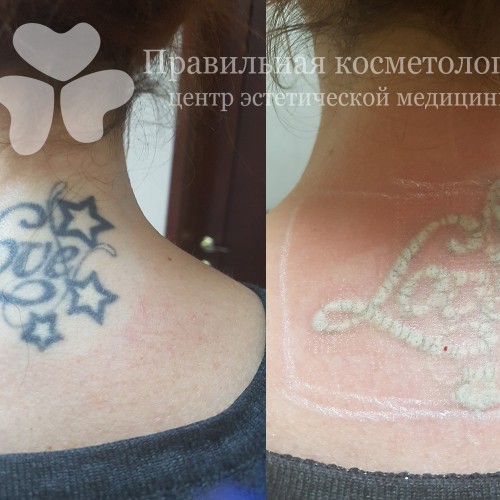 gallery_photo