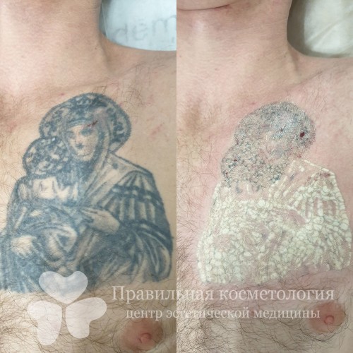 gallery_photo
