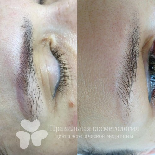gallery_photo
