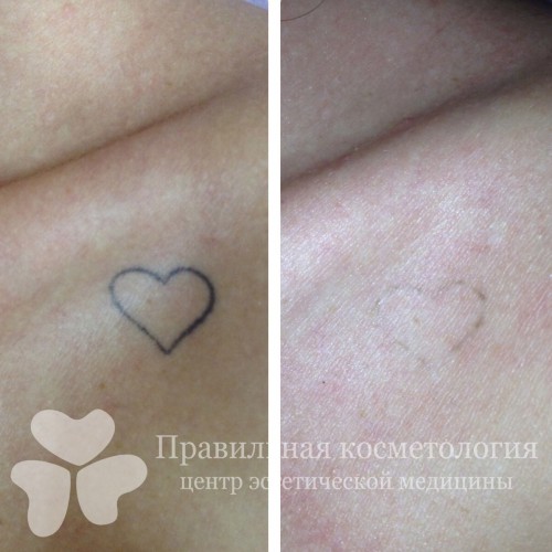 gallery_photo