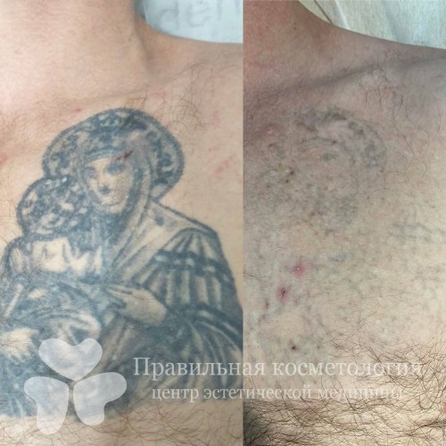 gallery_photo