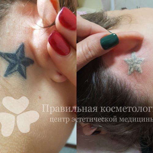 gallery_photo