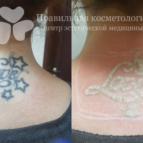 gallery_photo