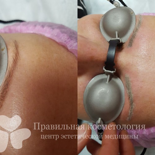 gallery_photo