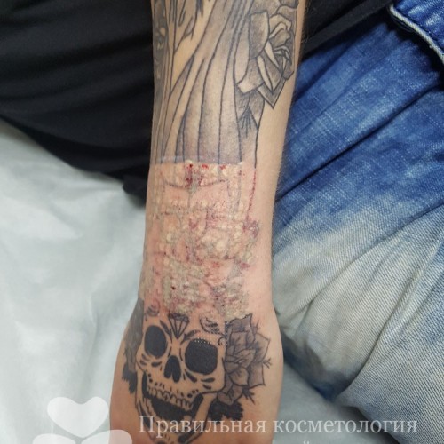 gallery_photo