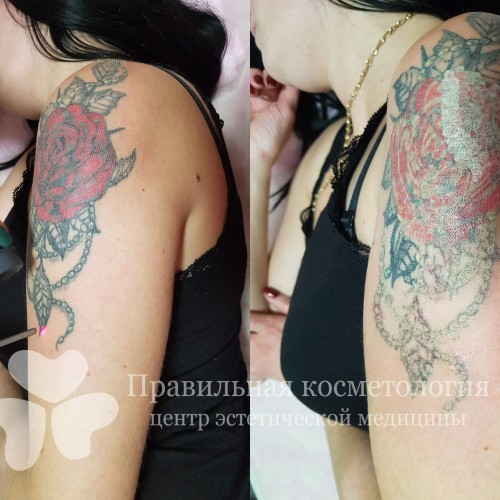 gallery_photo