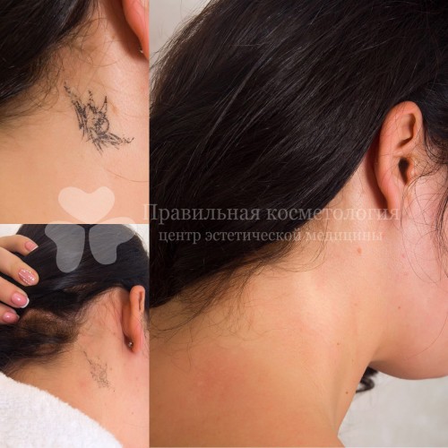 gallery_photo