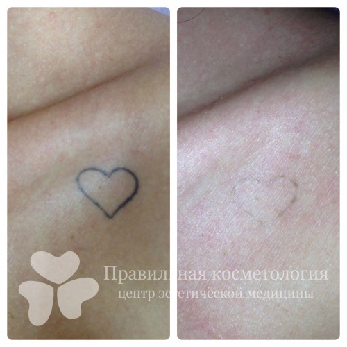 gallery_photo