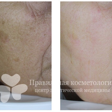 gallery_photo