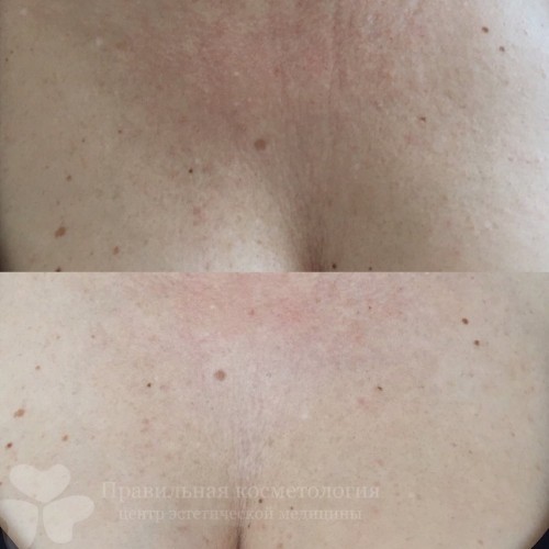 gallery_photo