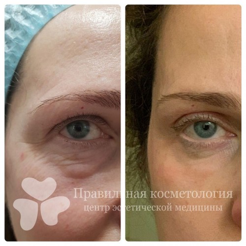 gallery_photo