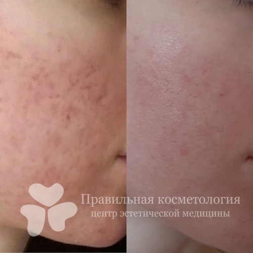gallery_photo