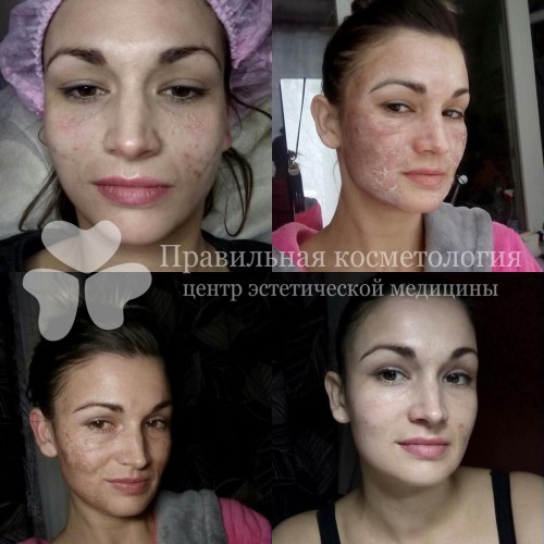 gallery_photo