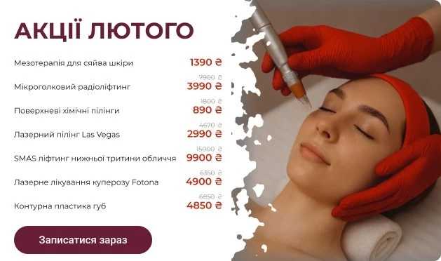 Акції лютого 2026 року