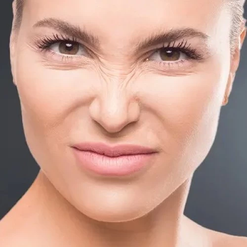 What Does the Face Look Like 10 Years After Botox? Debunking the Myths