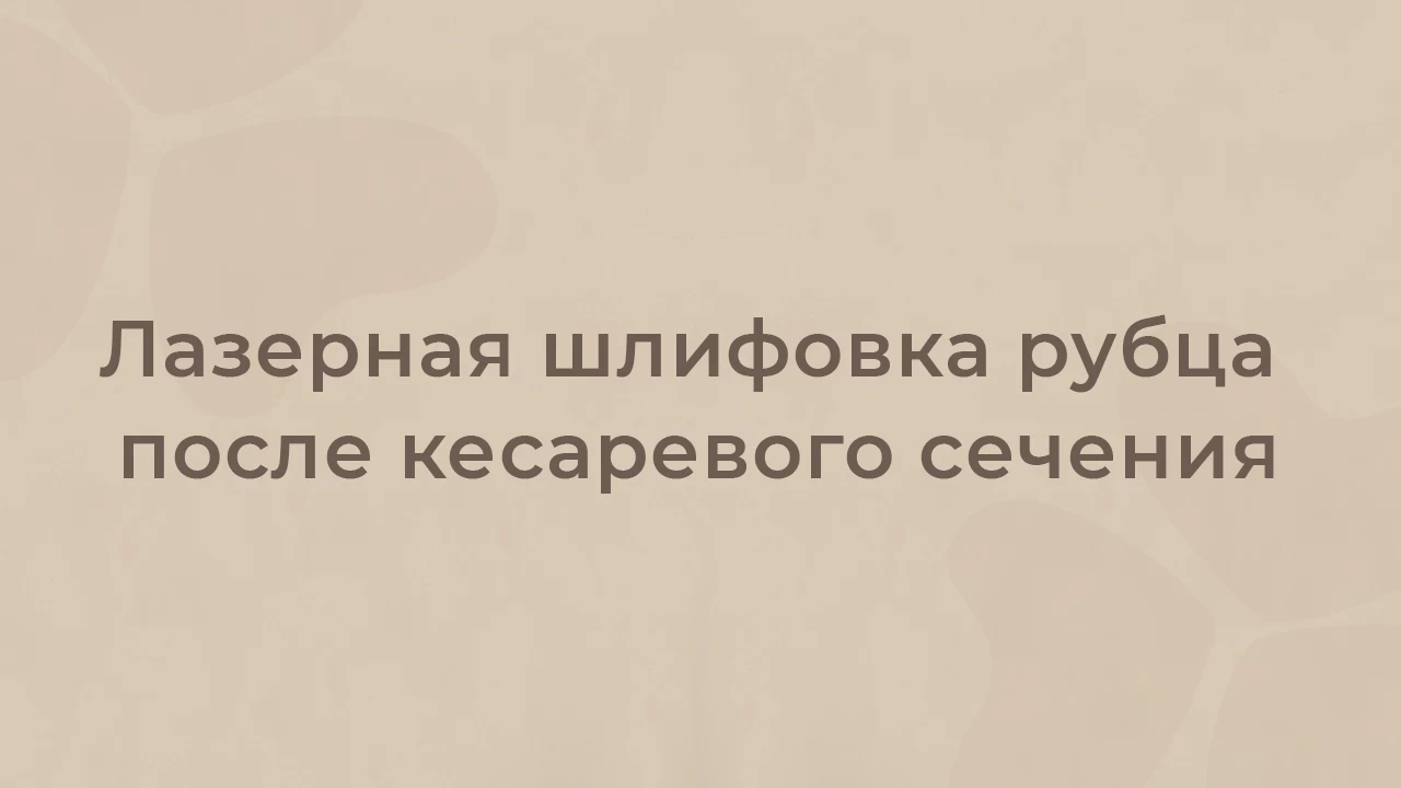 Лазерная шлифовка рубца после кесаревого сечения