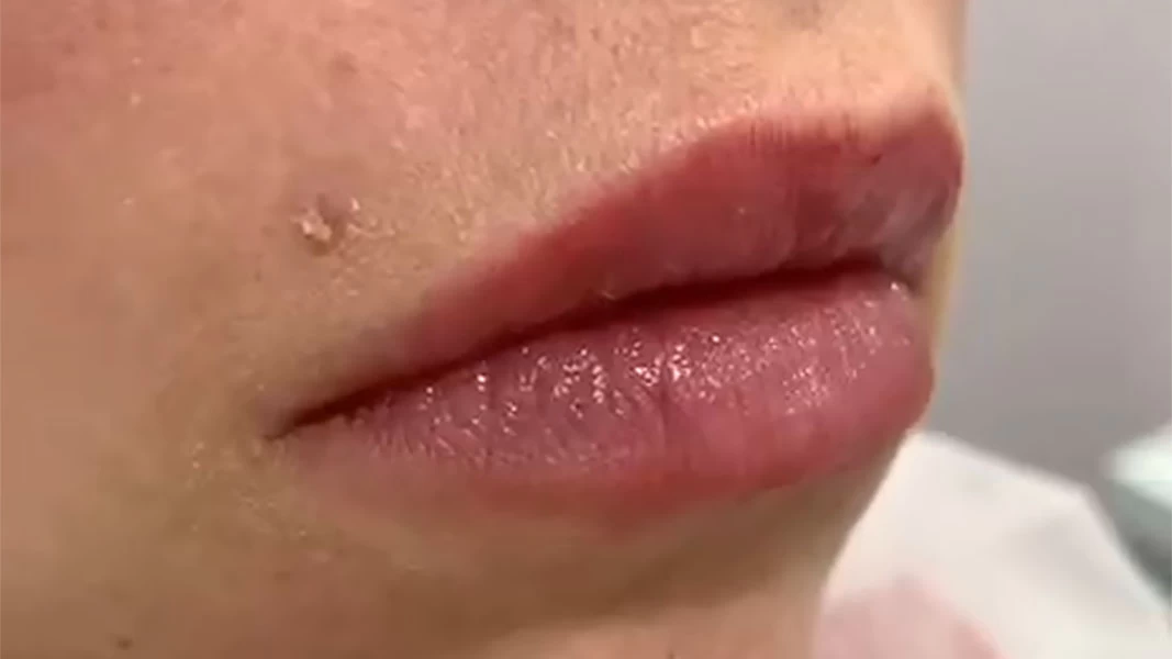 video